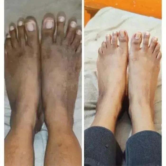 Lucacci Sinche Kojic Skin Whitening Facial Body Soap Pack of 3 - 300 g